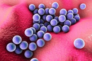 staphylococcus-aureus